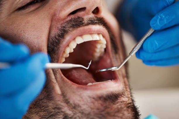 Best Emergency Denture Repair in Mount Ephraim, NJ