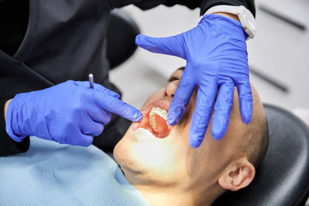 Best Lost Filling or Crown Replacement in Mount Ephraim, NJ