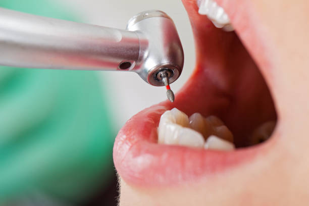 Best Dental Abscess Treatment in Mount Ephraim, NJ